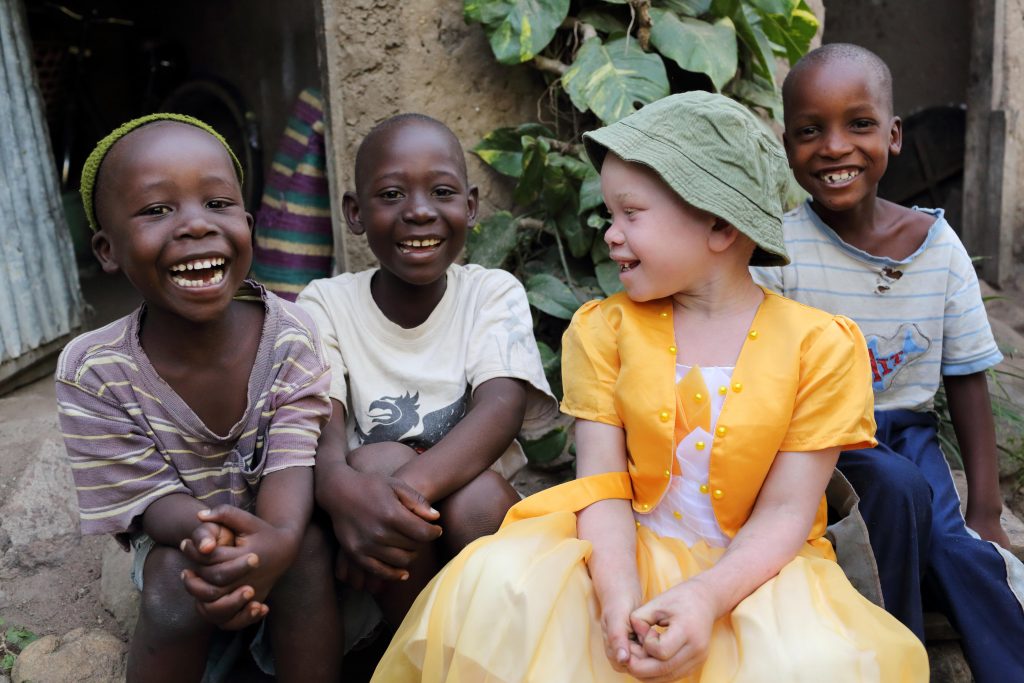 Three boys sit together with a girl with albinism, she wears a yellow dress and a green sun hat. all the children laugh
