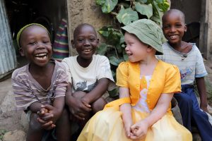 Three boys sit together with a girl with albinism, she wears a yellow dress and a green sun hat. all the children laugh